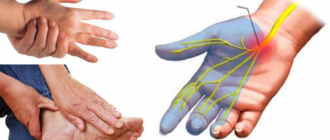 Дегидратация и онемение конечностей