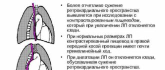 Дилатация ЛП: (