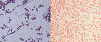 Микроскопическое (бактериоскопическое) исследование мазка, окрашенного по Граму (Gram Stain. Bacteri
