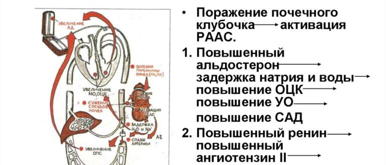 Влияние камней в почках на артериальное давление