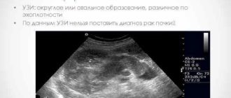 Диагноз по УЗИ ДХМИ