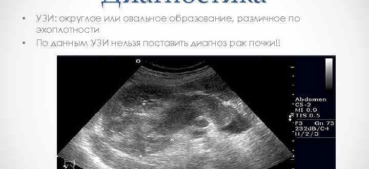 Диагноз по УЗИ ДХМИ