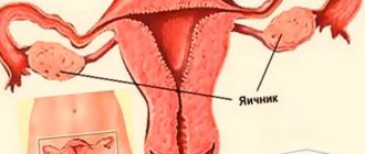 Возможно ли забеременеть с одним яичником