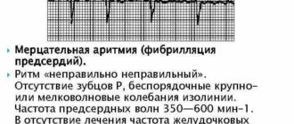 Мерцательная аритмия, высокое давление