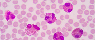 Эозинофилы крови