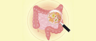 Дисбактериоз или нет