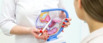 Чем вылечить молочницу при беременности 23 недели