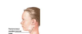 Длительное увеличение тонзиллярных узлов у ребенка