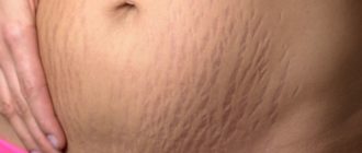 Волосы на животе, ногах, вокруг сосков, на бедрах