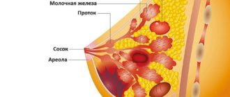 Диагноз ДФАМ