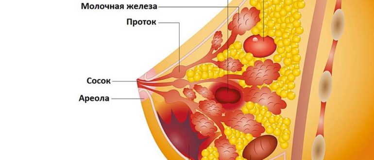 Диагноз ДФАМ