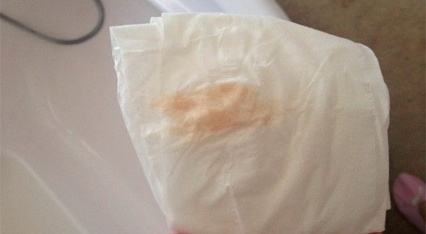 Выделения персикового цвета