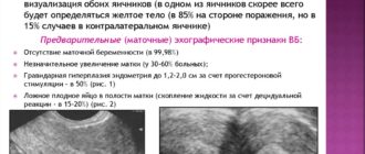 УЗИ для исключения внематочной беременности