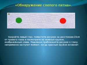 Находясь на улице появляются точке в правом глазу