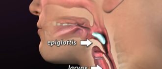 Мешает надгортанник