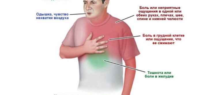 Давящая боль в области сердца, учащенное сердцебиение, онемение правой руки