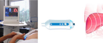 Надо ли делать фиброскан?