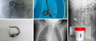 Возможно проглотила часть цепочки