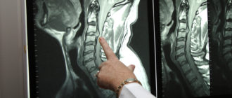 Чем заменить МРТ шейного отдела?