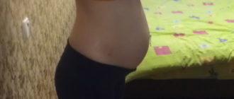 На 14 неделе живот с одной стороны больше