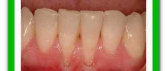 Десна как-будто опустилась