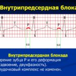 Как бороться с Отитом у детей