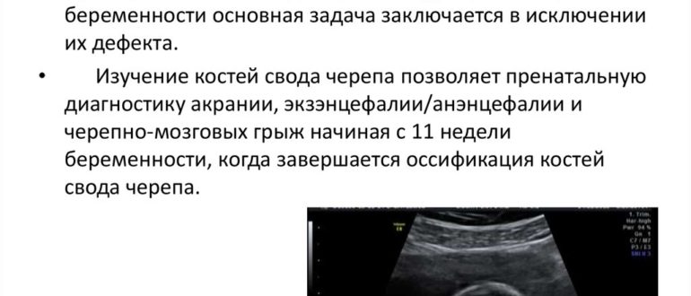 Кости свода черепа, первое узи, патология или нет