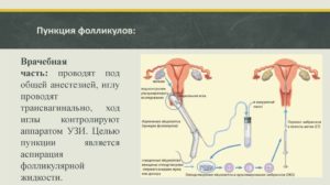 Дюфастон после пункции фолликулов