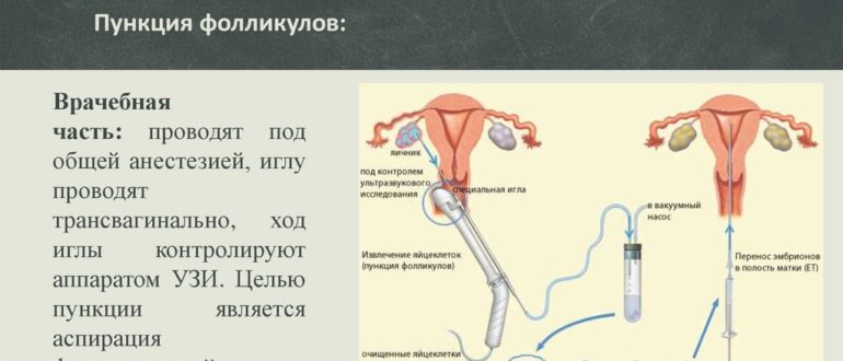 Дюфастон после пункции фолликулов