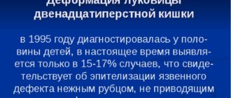 Деформация луковицы