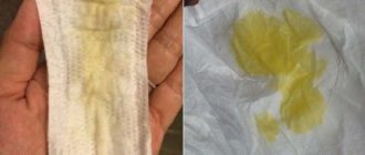 Выделения желто- коричневого цвета