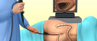 Впр кишечника: есть ли необходимость обследования