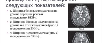Что делать при атрофии мозга 1 степени
