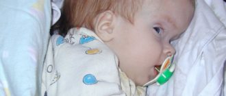 Можно ли делать Прививки при Гидроцефалии неуточненной