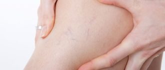 Венки на ногах