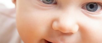 Врожденная катаракта у ребёнка