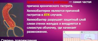 Диагноз махровый гастрит плюс хеликобактерии пилори