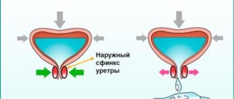 Мочеиспускание при смехе