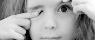 Дергается глаз у ребенка