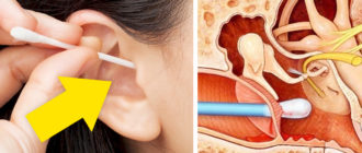 На палочке кровь, при чистке уха