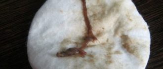 Возраст 47 лет две недели мажет вместо месячных