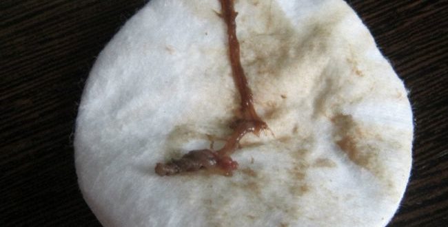 Возраст 47 лет две недели мажет вместо месячных