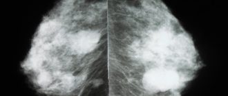 На рентгене груди и обычном УЗИ ничего нет