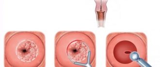 Можно ли делать биопсию шейки матки на 19 день цикла?