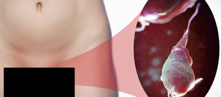 Можно ли, при наличии трихомонадной инфекции забеременеть?