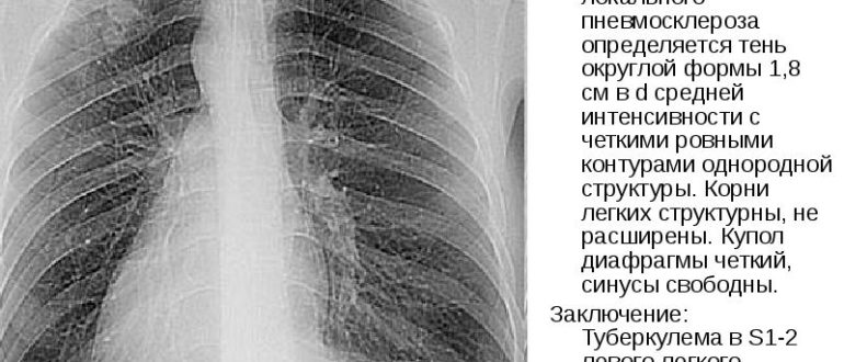 Образование округлой формы с четкими ровными контурами