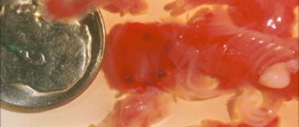 Месячные после замершей беременности