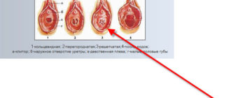 Могла ли я потерять девственность?