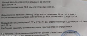 УЗИ на 18 день цикла