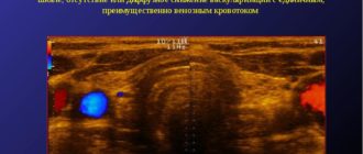 Что такое локусы васкуляризации